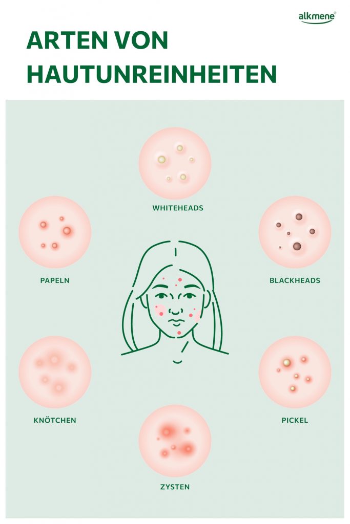 Arten von Hautunreinheiten Infografik