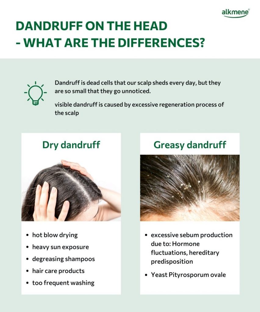 dandruff on the head what are the differences infographic