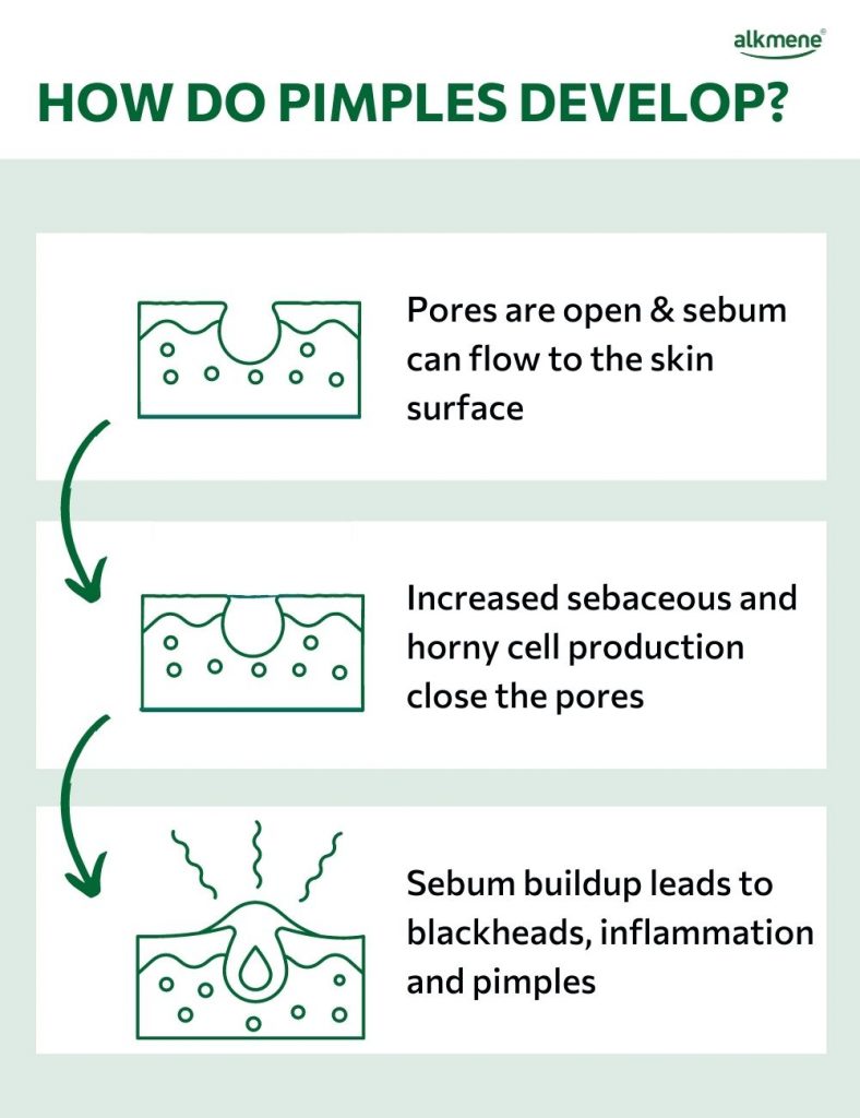 how do pimples develop infographic