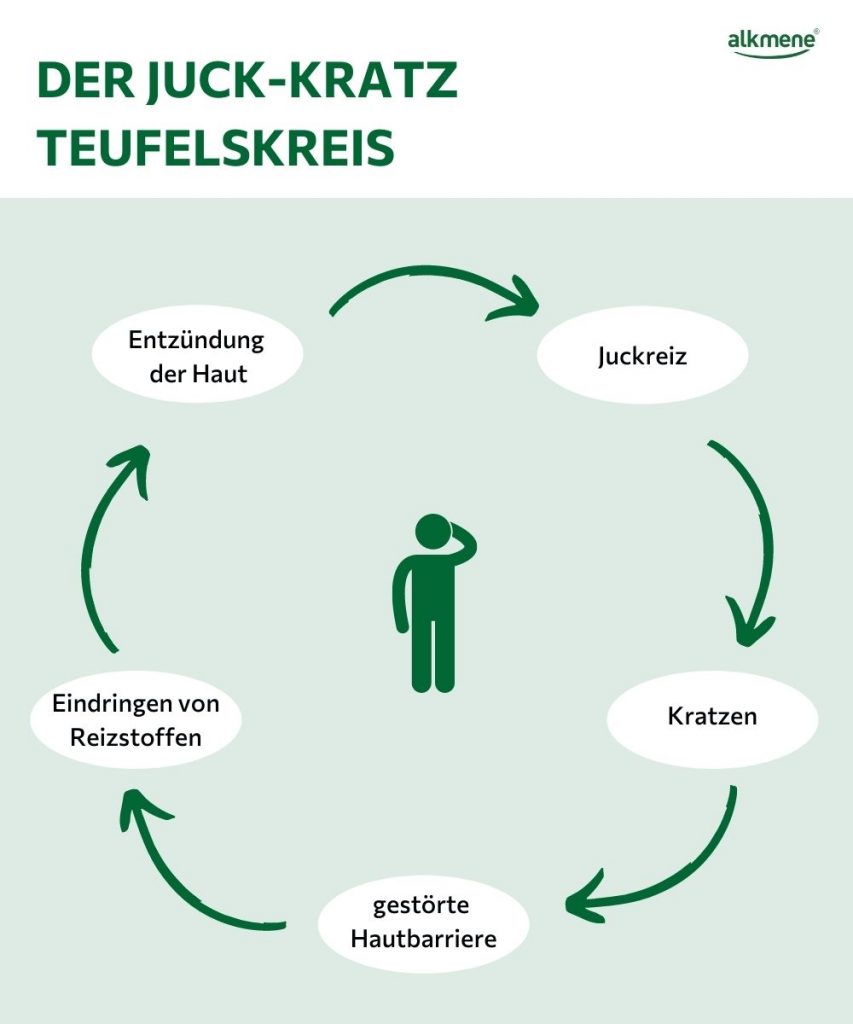 Juck-Kratz-Teufelskreis Infografik