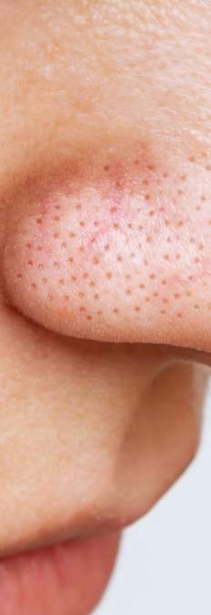 The reason you have that ONE annoying chin hair! - Times of India