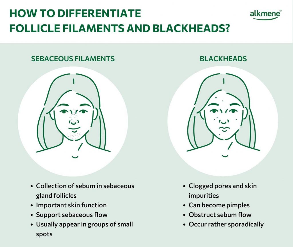 infographic on the difference between sebaceous filaments and blackheads 