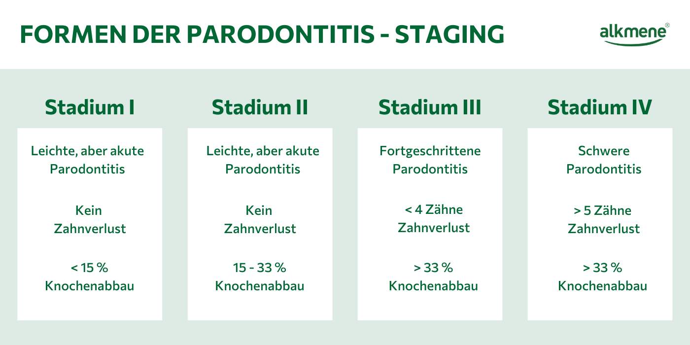 Infografik zu den Stadien einer Parodontitis