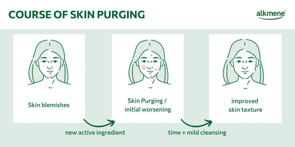 Infografic on the course of skin purging
