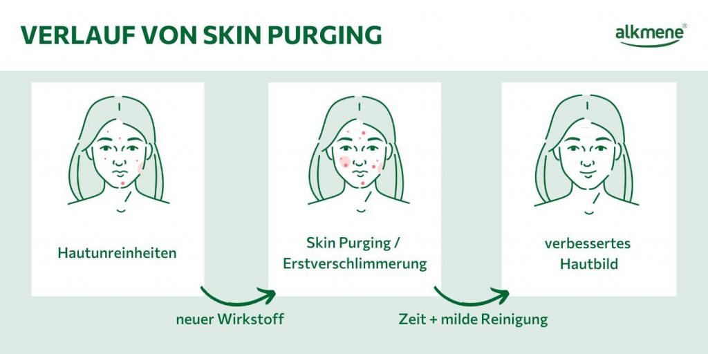 Infografik zum Verlauf von Skin Purging.