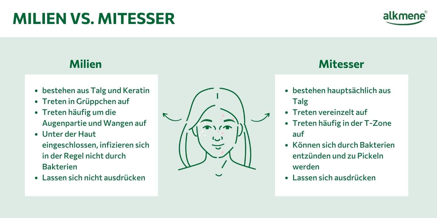 Milien oder Mitesser? Die Unterschiede